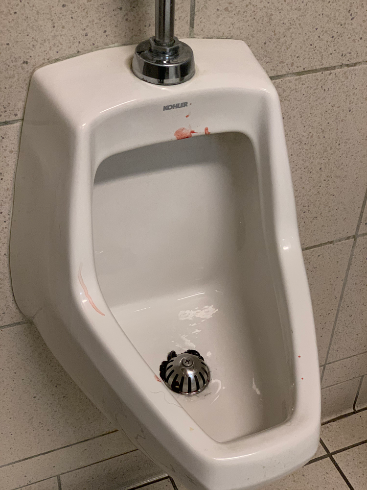 Man gets fresh perspective from pre-bloodied urinal